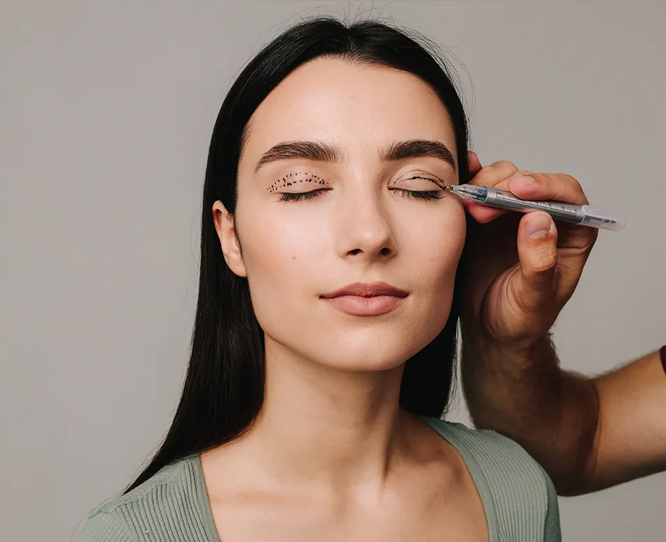blepharoplastie