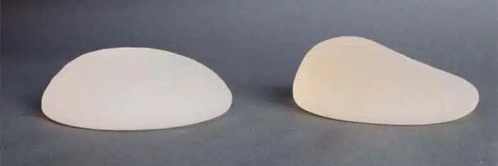 comparatif prothèse ronde (à gauche) et prothèse anatomique (à droite)